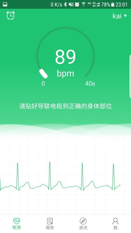 极简心电v3.0.24(1)