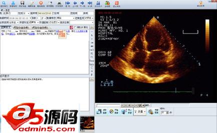 合肥翔翼互联超声工作站软件